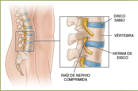 El dolor que duele bajo el borde derecho da en la espalda